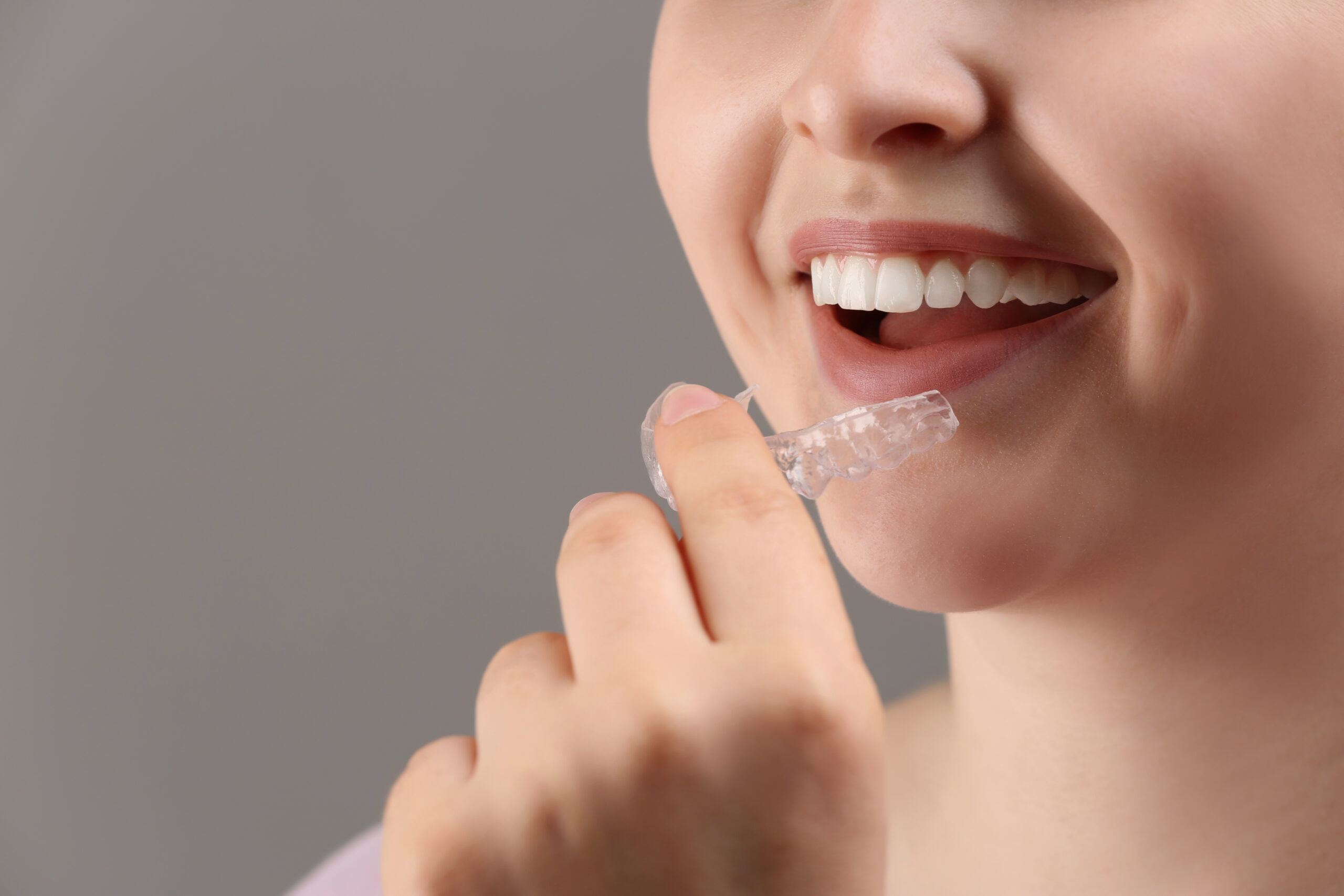 Zahnmedizinisches Modell mit zwei Implantaten und befestigter Zahnkrone